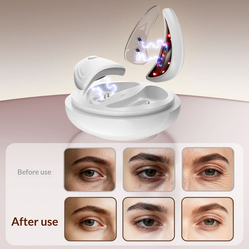 Masajeador Ocular Antiaojeras y Bolsas con Luz Roja